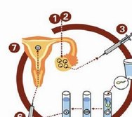 2026南宁十大试管婴儿医院名单表！南宁技术高的试管医院有哪些？