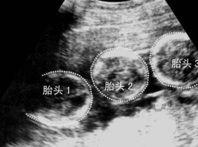 2026南京助孕机构榜单大公开，助孕服务哪家强？